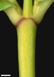 Veronica salicifolia. Portion of stem showing absence of hairs. Scale = 1 mm.
 Image: W.M. Malcolm © Te Papa CC-BY-NC 3.0 NZ